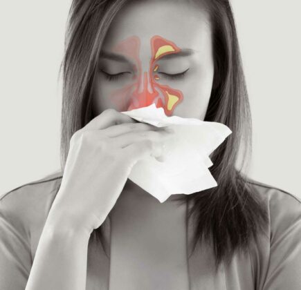 SinuSalt orröblítő légúti allergiásoknak